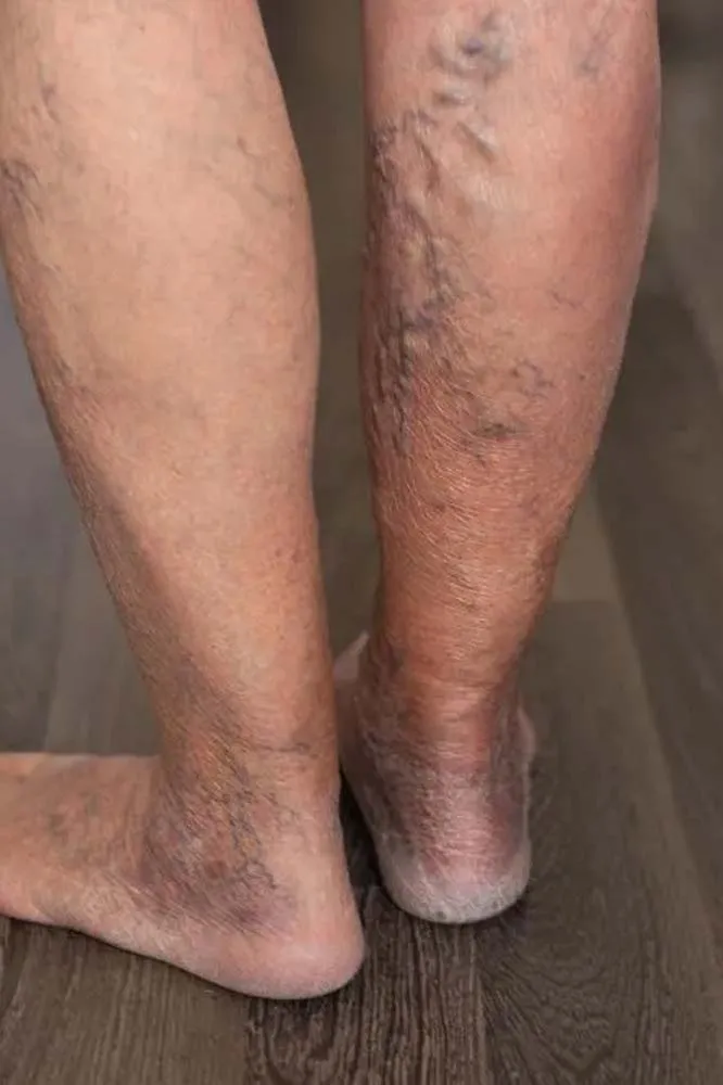 Vein Clinic